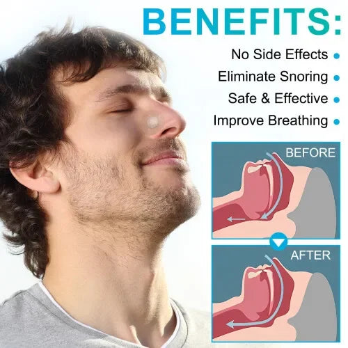 Magnetic Nasal Strips | Cotton Snore Relief Aid for Enhanced Airflow and Restful Sleep